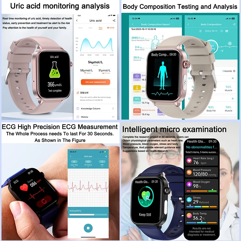 2025 New For XIAOM1 ECG+PPG Bl - đánh giá và giá Smartwatch Health Watches For Women